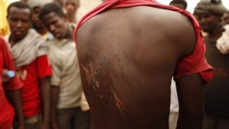 Koacinaute : Face à  lÂ’affront français, le Maroc mérite bien mieux quÂ’un communiqué laconique.